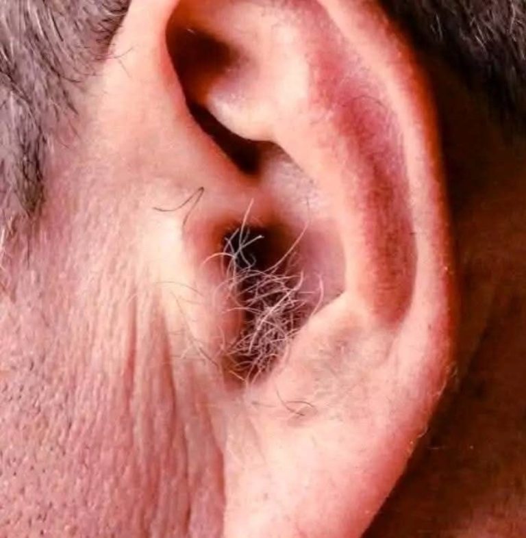 Czy wiesz, że jeśli w uszach rosną Ci włosy, to dlatego, że Twój organizm